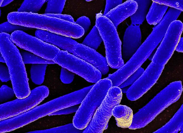 E. coli provoque le plus souvent le développement de la cystite chez la femme