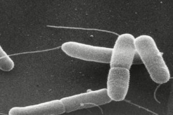 Causes de la cystite